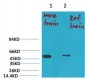 Kv1.1 potassium channel Polyclonal Antibody